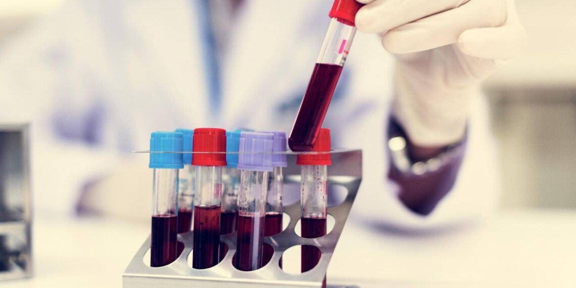 Come vivere più a lungo? Il test del sangue svela la longevità