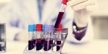 Come vivere più a lungo? Il test del sangue svela la longevità